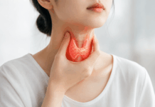 갑상선기능항진증, 몸이 쉬지 않고 과열되는 상태…조기 진단과 꾸준한 관리 중요
