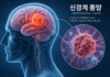신경섬유종증, 피부 반점부터 신경 종양까지…조기 진단 중요
