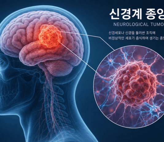 신경섬유종증, 피부 반점부터 신경 종양까지…조기 진단 중요